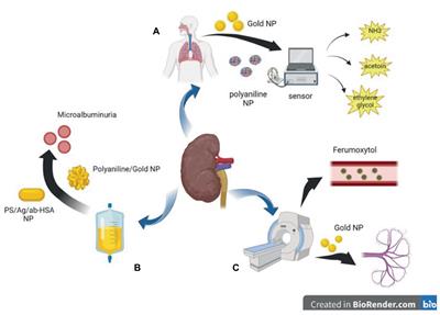 Application of nanoparticles in the diagnosis and treatment of chronic kidney disease